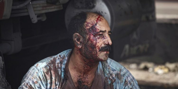 Deadly explosion shakes Iran, hundreds hospitalised after port fire | Gallery News Deadly explosion shakes Iran, hundreds hospitalised after port fire | Gallery News